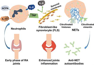 Neutrophil Extracellular Traps Tied to Rheumatoid Arthritis: Points to Ponder